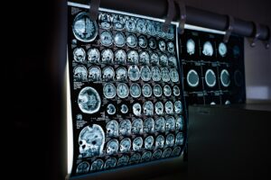 年賀状の宛名をスキャンするためのおすすめアプリは？